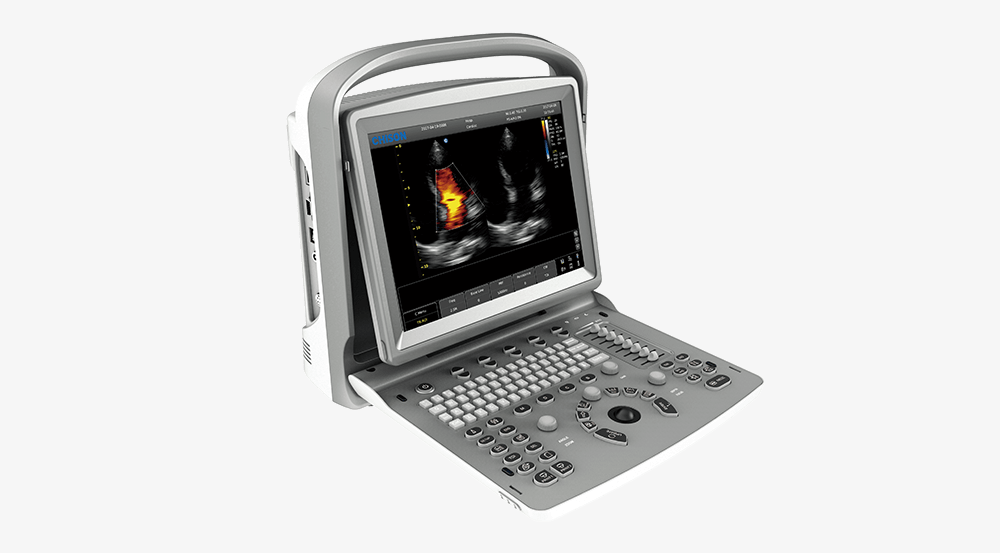 portable ultrasound machine.png